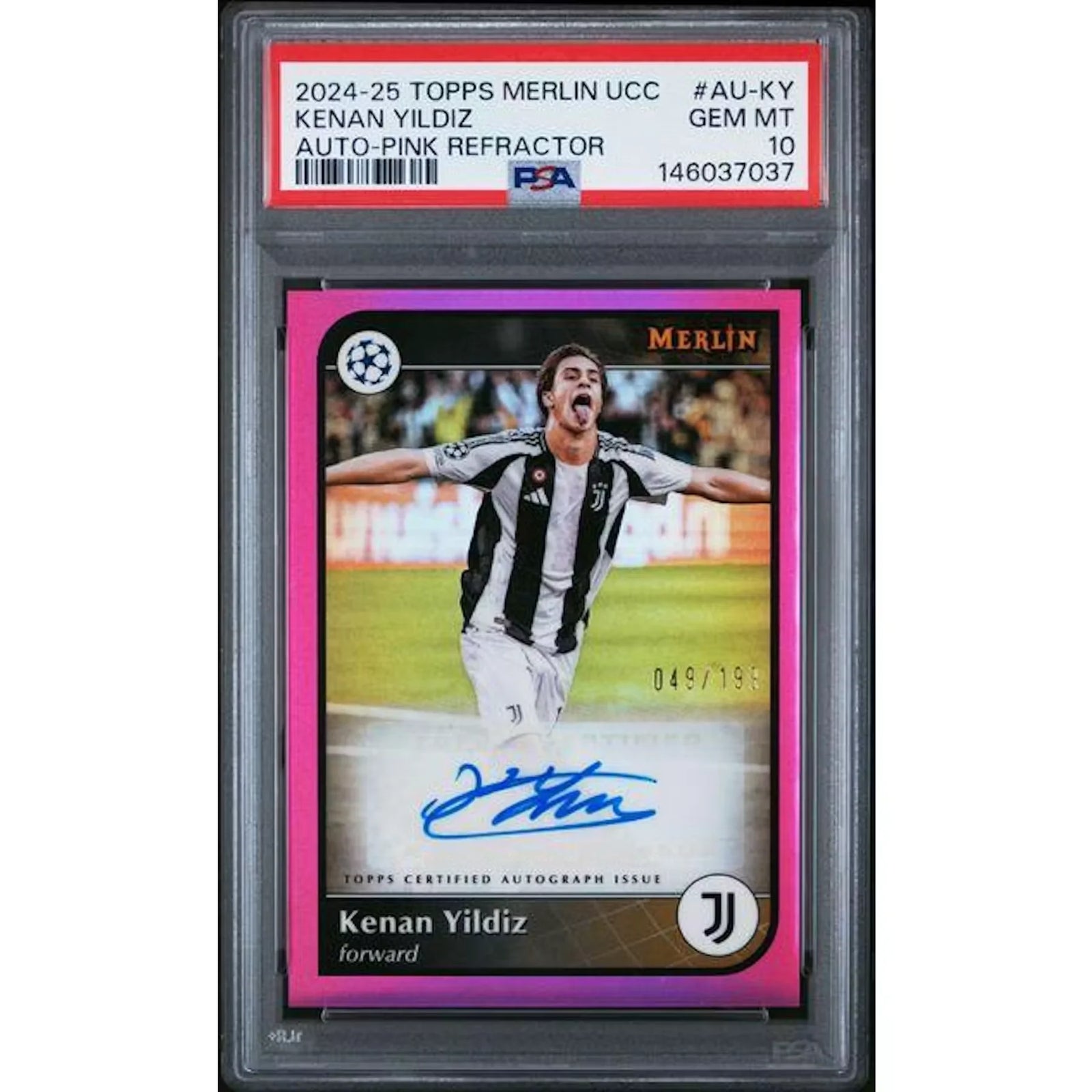Kenan Yildiz Signed 2024-25 Topps Merlin UCC Card | Pink Refractor PSA 10